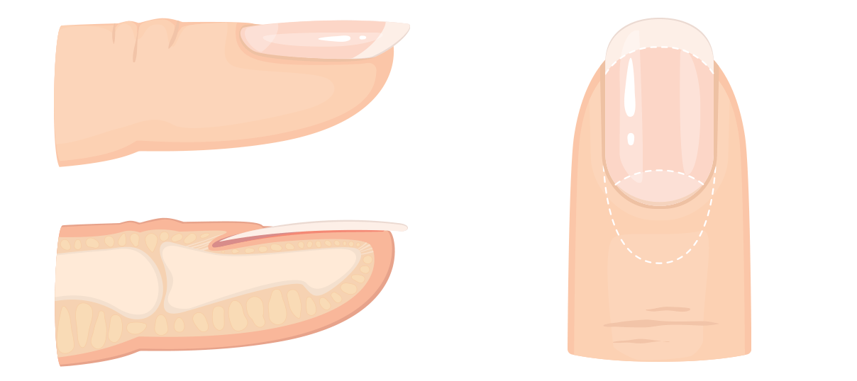 NAIL STRUCTURE