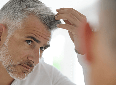 Preventing and treating androgenic alopecia